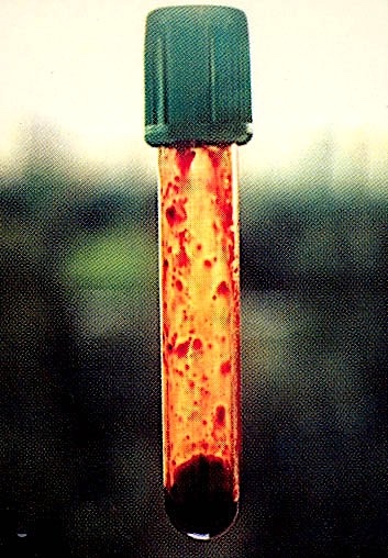 Holy relic: a test tube with the incorrupt blood of Archimandrite Gabriel (Urgebadze)